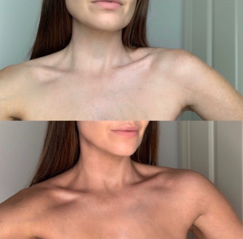 Self-Tan Mousse | Before & After